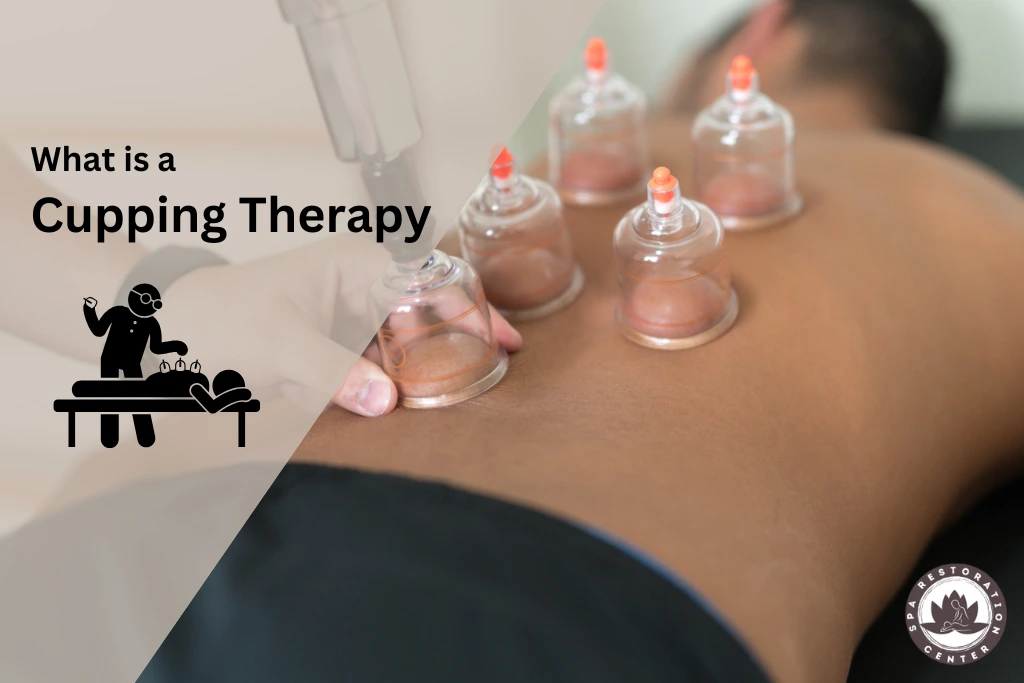 what is a cupping therapy