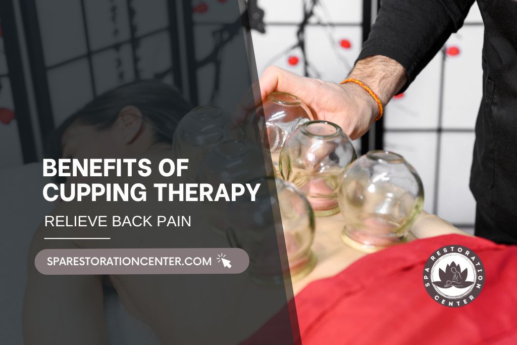 Benefits of Cupping Therapy (1)