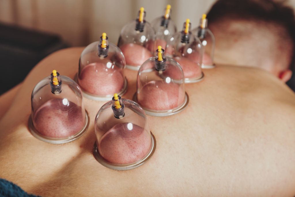 Purpose of cupping massage
