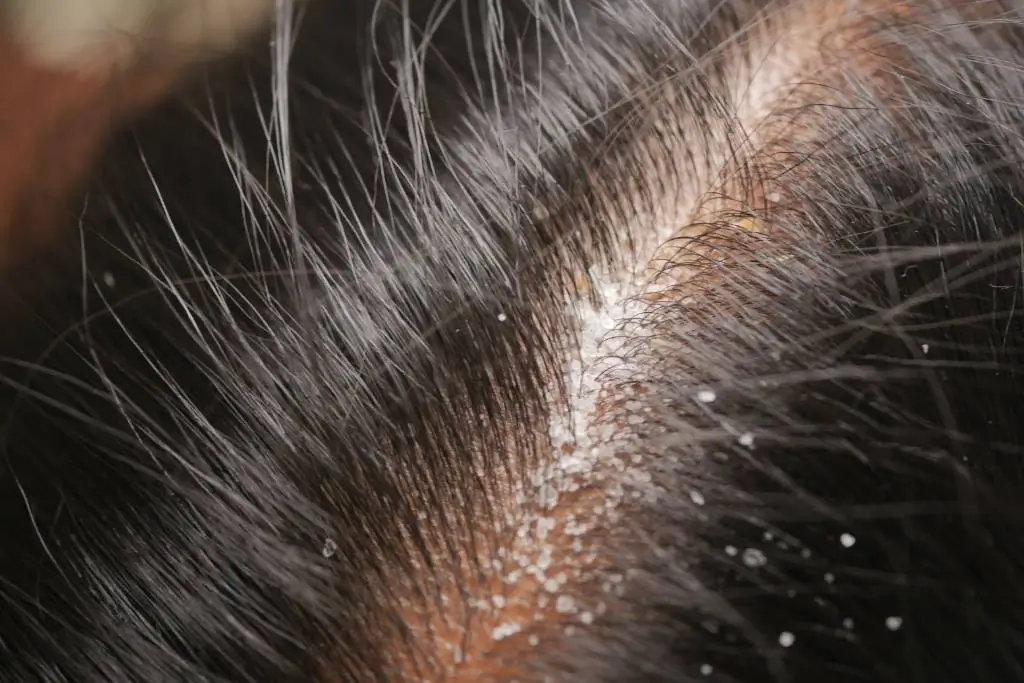 Scalp Inflammation Problem