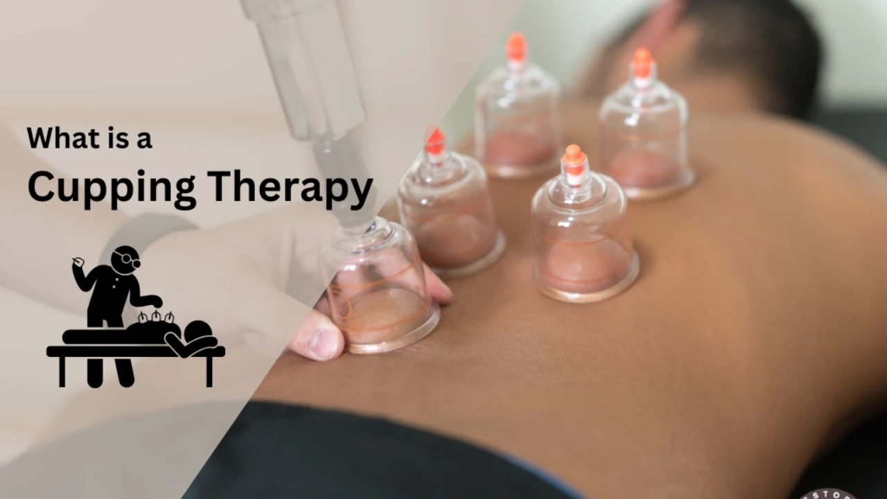 what is a cupping therapy