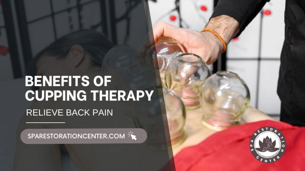 Benefits of Cupping Therapy (1)