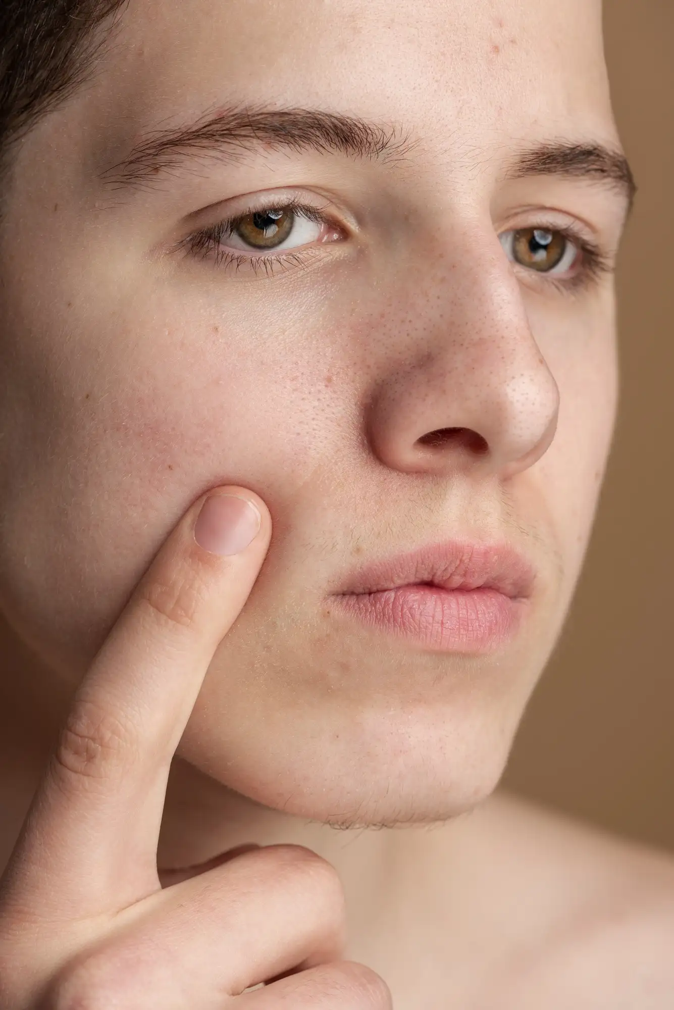 Clogged pores