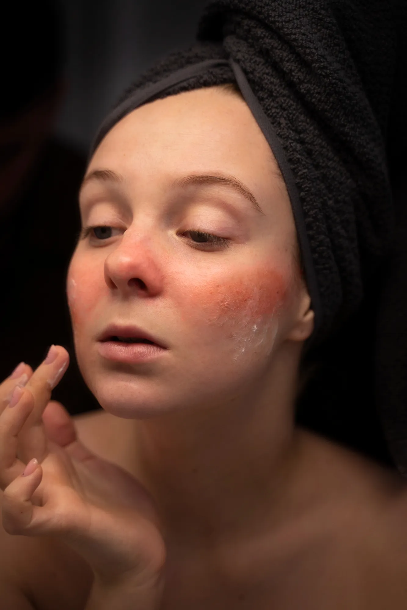 Dry and rough skin